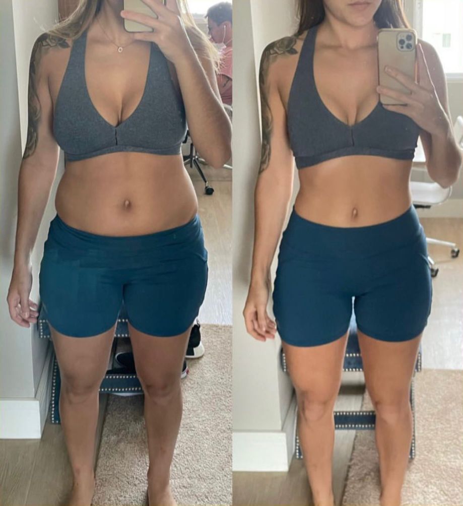 Antes e depois