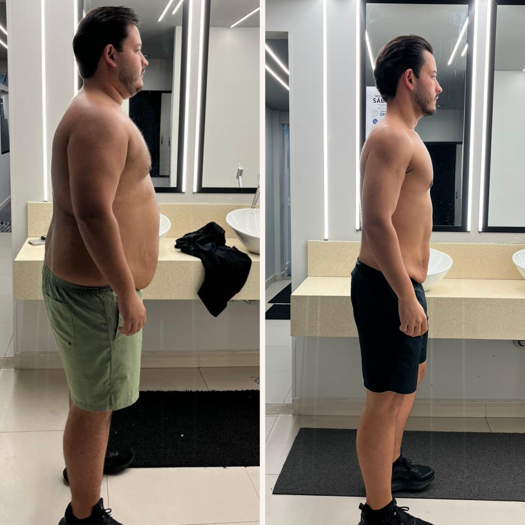 Antes e depois